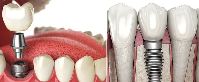 dentist clinic in bandra west