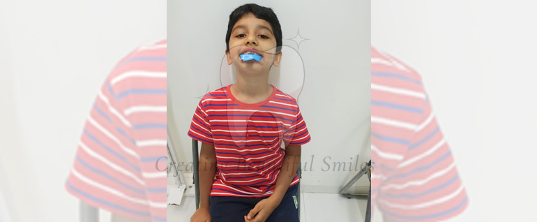 best dentist in chapel road bandra west