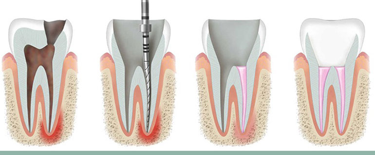 the best dental clinic in bandra west, mumbaik