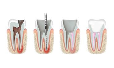 dentist clinic in bandra west