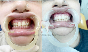  dentist video consultation